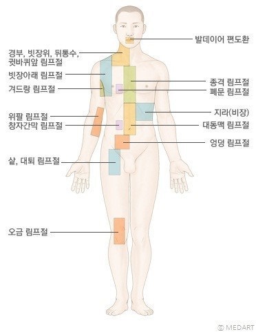 결합 조직 림프절