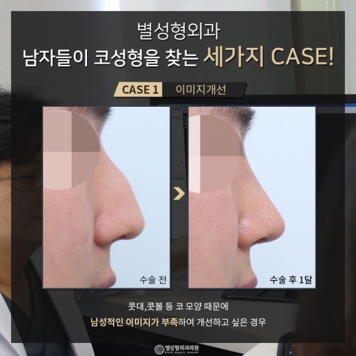 별성형외과 | BAND 별성형외과 | Band