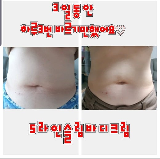 에스라인 이미지