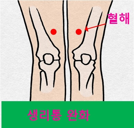 생리통 생리전증후군 관리법