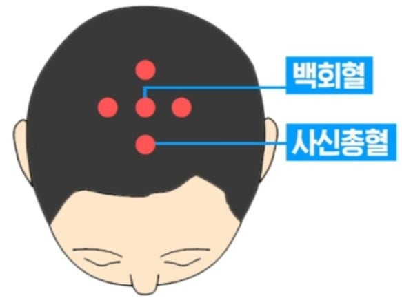 헤어큐 이미지