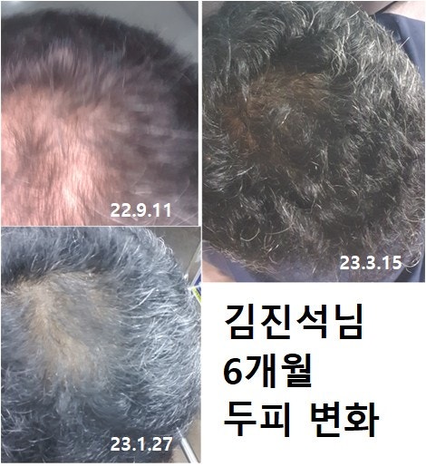 건강테라피 이미지