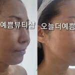 바른체형뷰티샵 이미지